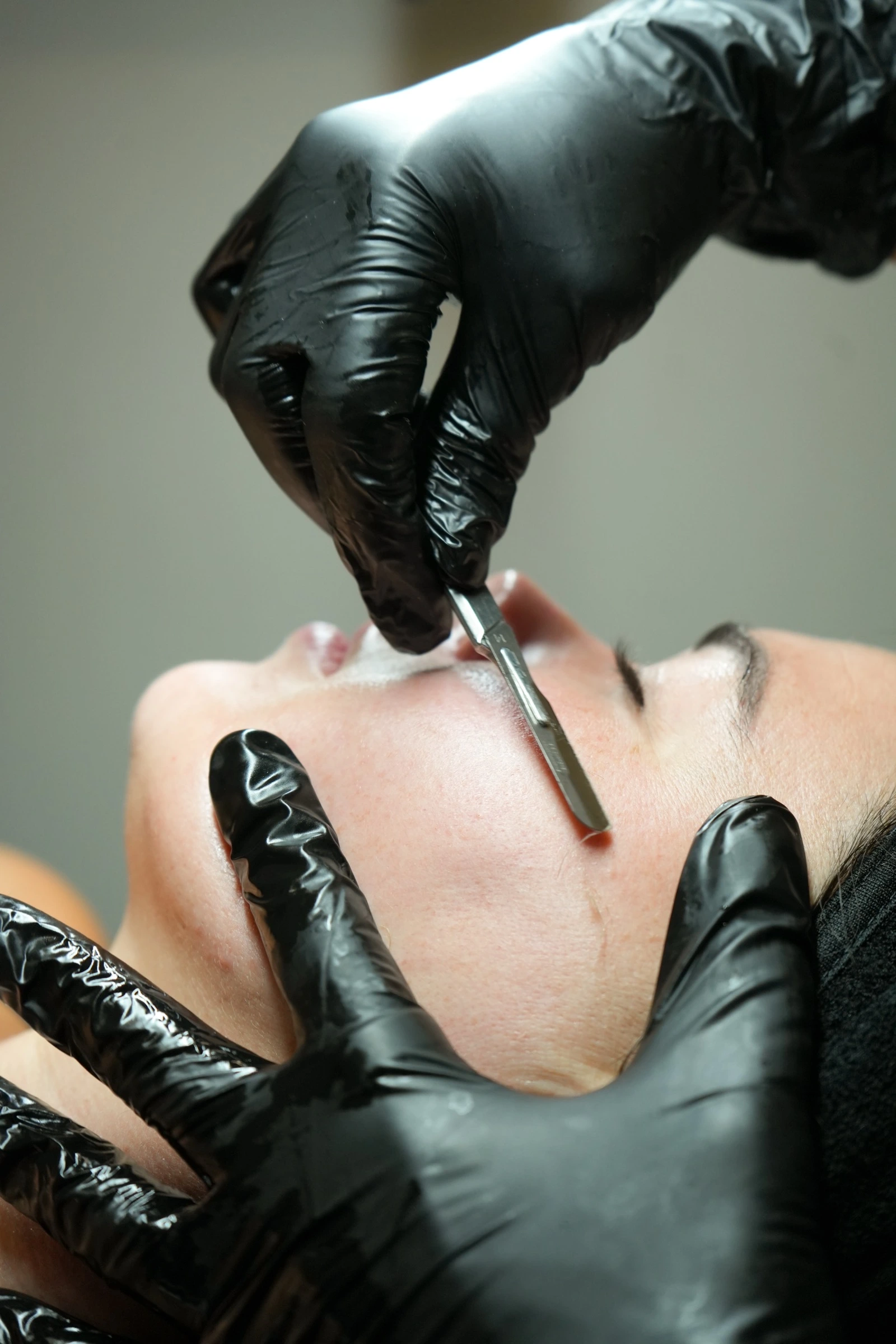 Dermaplaning treatment detail for medspa social content